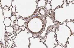 Invitrogen p27Kip1 Recombinant Rabbit Monoclonal Antibody (HL2508) 100