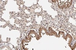 Invitrogen p27Kip1 Recombinant Rabbit Monoclonal Antibody (HL2508) 100