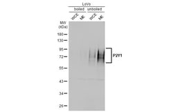 P2Y1 Recombinant Rabbit Monoclonal Antibody (HL2702):Antibodies, Recombinant