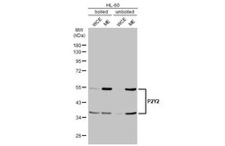 P2Y2 Recombinant Rabbit Monoclonal Antibody (HL2704):Antibodies, Recombinant