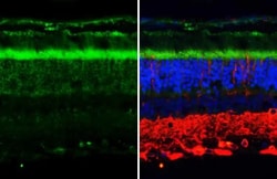 Invitrogen P2Y2 Recombinant Rabbit Monoclonal Antibody (HL2801) 100 &mu;L;