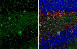 Invitrogen P2Y2 Recombinant Rabbit Monoclonal Antibody (HL2801) 100 &mu;L;