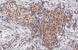 Invitrogen Phospho-p38 MAPK (Tyr182) Recombinant Rabbit Monoclonal Antibody