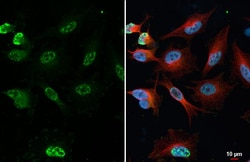 Phospho-p38 MAPK (Tyr182) Recombinant Rabbit Monoclonal Antibody (HL2741):Antibodies,