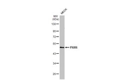 Invitrogen PAX6 Recombinant Rabbit Monoclonal Antibody (HL2599) 100 &mu;L;