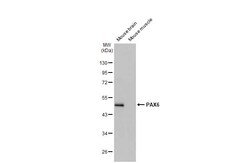 Invitrogen PAX6 Recombinant Rabbit Monoclonal Antibody (HL2599) 100 &mu;L;