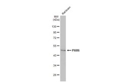Invitrogen PAX6 Recombinant Rabbit Monoclonal Antibody (HL2599) 100 &mu;L;