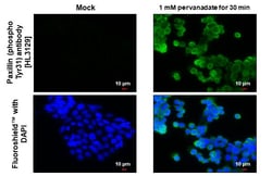 Phospho-Paxillin (Tyr31) Recombinant Rabbit Monoclonal Antibody (HL3129):Antibodies,