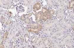 Invitrogen PSAT1 Recombinant Rabbit Monoclonal Antibody (HL2663) 100 &mu;L;