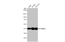 Invitrogen PSAT1 Recombinant Rabbit Monoclonal Antibody (HL2663) 100 &mu;L;
