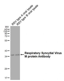 Invitrogen RSV M Protein Recombinant Rabbit Monoclonal Antibody (HL3000)
