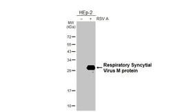 Invitrogen RSV M Protein Recombinant Rabbit Monoclonal Antibody (HL3000)