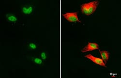 Invitrogen RFC1 Recombinant Rabbit Monoclonal Antibody (HL3242) 100 &mu;L;