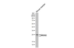 Invitrogen RGS2 Recombinant Rabbit Monoclonal Antibody (HL2988) 100 &mu;L;