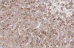 Invitrogen ROBO1 Recombinant Rabbit Monoclonal Antibody (HL2559) 100 &mu;L;