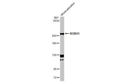 Invitrogen ROBO1 Recombinant Rabbit Monoclonal Antibody (HL2559) 100 &mu;L;
