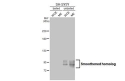 Invitrogen SMO Recombinant Rabbit Monoclonal Antibody (HL2975) 100 &mu;L;