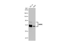 Invitrogen SNRK Recombinant Rabbit Monoclonal Antibody (HL2225) 100 &mu;L;