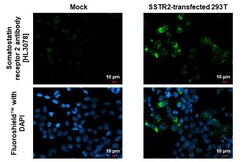 Invitrogen SSTR2 Recombinant Rabbit Monoclonal Antibody (HL3078) 100 &mu;L;