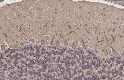 Invitrogen SSTR3 Recombinant Rabbit Monoclonal Antibody (HL2681) 100 &mu;L;