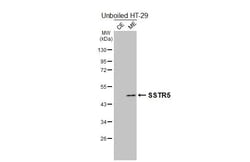 Invitrogen SSTR5 Recombinant Rabbit Monoclonal Antibody (HL2756) 100 &mu;L;