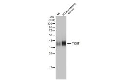 Invitrogen TIGIT Recombinant Rabbit Monoclonal Antibody (HL2655) 100 &mu;L;