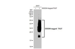 Invitrogen TIGIT Recombinant Rabbit Monoclonal Antibody (HL2655) 100 &mu;L;