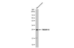 Invitrogen TMEM119 Recombinant Rabbit Monoclonal Antibody (HL2627) 100