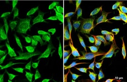 Invitrogen TSC2 Recombinant Rabbit Monoclonal Antibody (HL2974) 100 &mu;L;