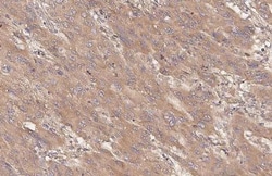 Invitrogen TSC2 Recombinant Rabbit Monoclonal Antibody (HL2974) 100 &mu;L;