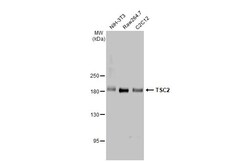 Invitrogen TSC2 Recombinant Rabbit Monoclonal Antibody (HL2974) 100 &mu;L;