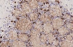 Invitrogen Tyrosine Hydroxylase Recombinant Rabbit Monoclonal Antibody