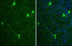 Invitrogen Tyrosine Hydroxylase Recombinant Rabbit Monoclonal Antibody
