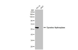 Invitrogen Tyrosine Hydroxylase Recombinant Rabbit Monoclonal Antibody