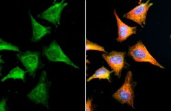 Invitrogen VCP Recombinant Rabbit Monoclonal Antibody (HL3018) 100 &mu;L;