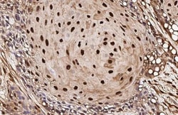 Invitrogen VCP Recombinant Rabbit Monoclonal Antibody (HL3018) 100 &mu;L;