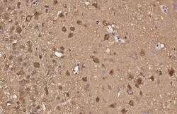 Invitrogen VCP Recombinant Rabbit Monoclonal Antibody (HL3018) 100 &mu;L;