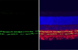 Invitrogen VAChT Recombinant Rabbit Monoclonal Antibody (HL2900) 100 &mu;L;