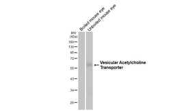 Invitrogen VAChT Recombinant Rabbit Monoclonal Antibody (HL3053) 100 &mu;L | Buy Online | Invitrogen&trade; | Fisher Scientific