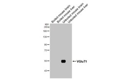 Invitrogen VGLUT1 Recombinant Rabbit Monoclonal Antibody (HL3210) 100 &mu;L;