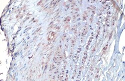 Invitrogen Vimentin Recombinant Rabbit Monoclonal Antibody (HL1506) 100