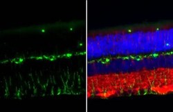 Invitrogen Vimentin Recombinant Rabbit Monoclonal Antibody (HL1506) 100