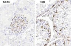 Invitrogen Vimentin Recombinant Rabbit Monoclonal Antibody (HL1506) 100