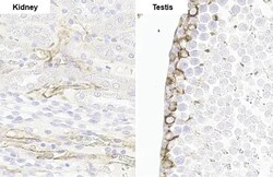 Invitrogen Vimentin Recombinant Rabbit Monoclonal Antibody (HL1506) 100