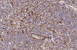 Invitrogen Vimentin Recombinant Rabbit Monoclonal Antibody (HL1506) 100