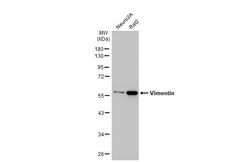 Invitrogen Vimentin Recombinant Rabbit Monoclonal Antibody (HL1506) 100