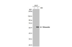 Invitrogen Vimentin Recombinant Rabbit Monoclonal Antibody (HL1506) 100