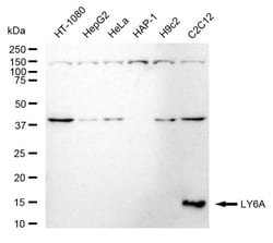Invitrogen Ly-6A/E Recombinant Rabbit Monoclonal Antibody (24GB370):Antibodies:Primary