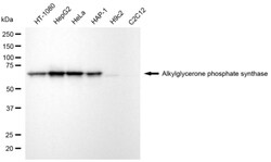 Invitrogen AGPS Recombinant Rabbit Monoclonal Antibody (24GB6810) 20 &mu;L;