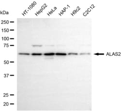 Invitrogen ALAS2 Recombinant Rabbit Monoclonal Antibody (24GB6795) 20 &mu;L;